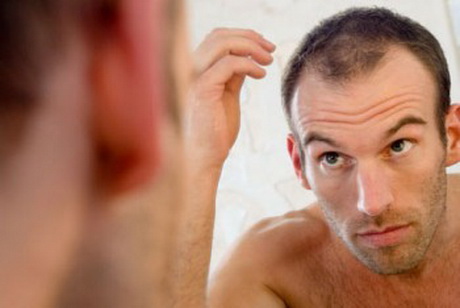 corte-masculino-para-quem-tem-pouco-cabelo-58_7 Corte masculino para quem tem pouco cabelo